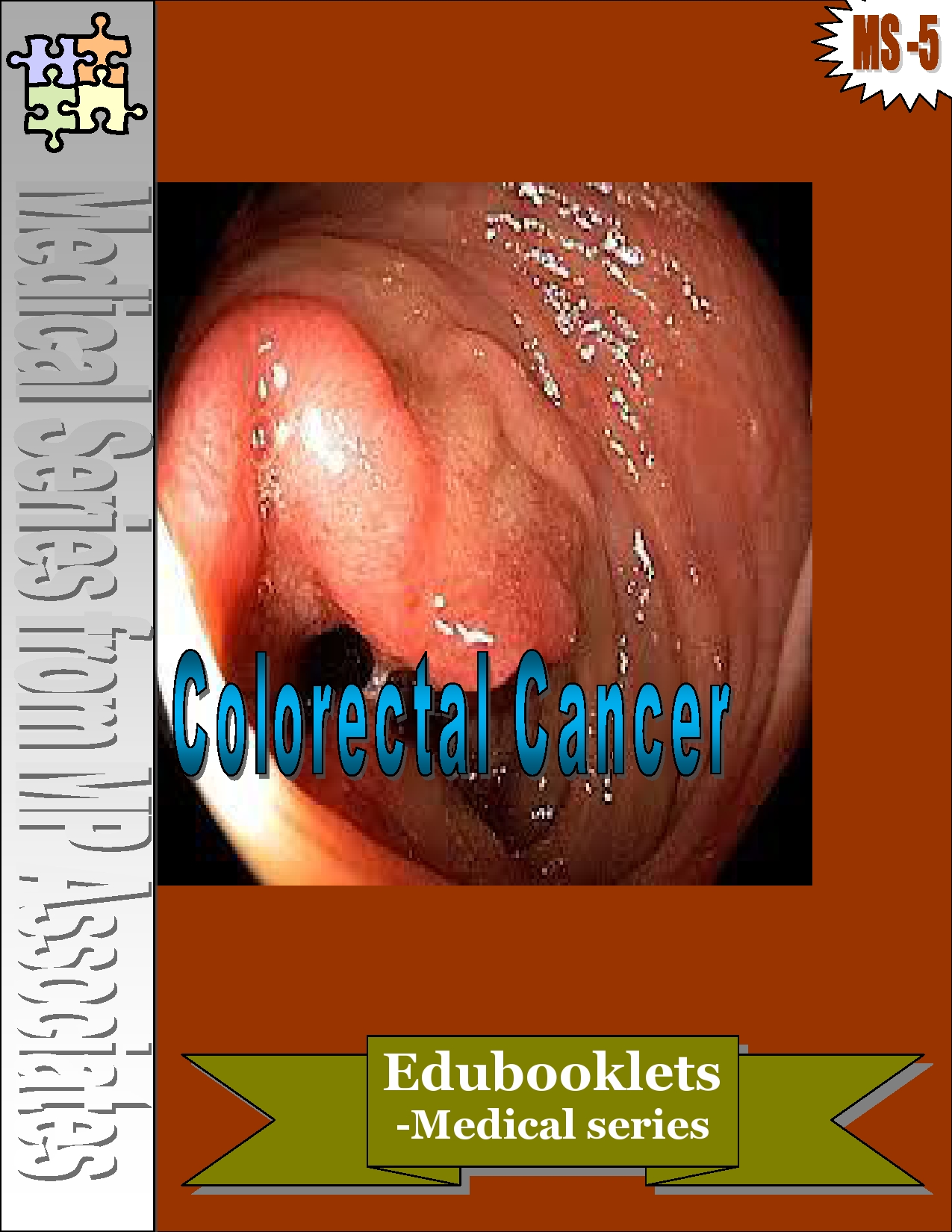 Colorectal Cancer